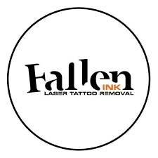 FALLEN INK TATTOO REMOVAL
