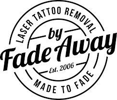 FADE AWAY TATTOO REMOVAL